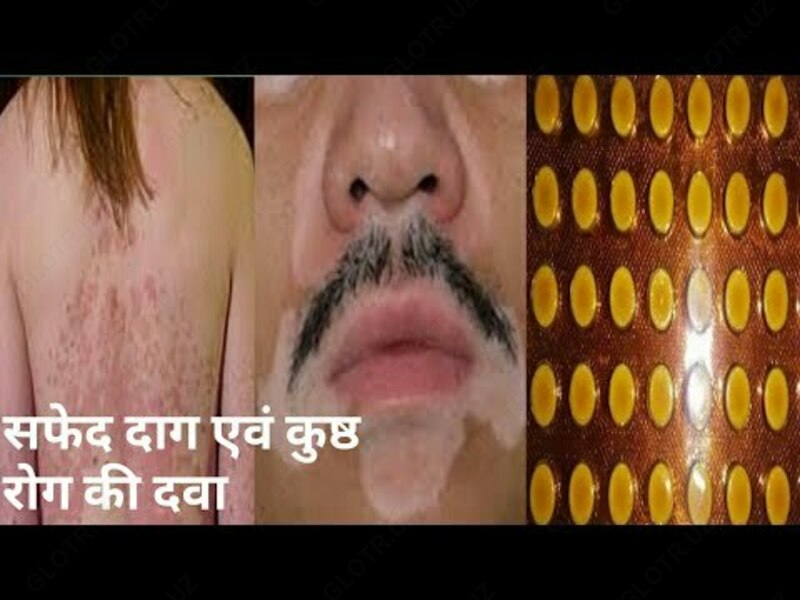 Melanotsil tabletkalari Chakana savdo