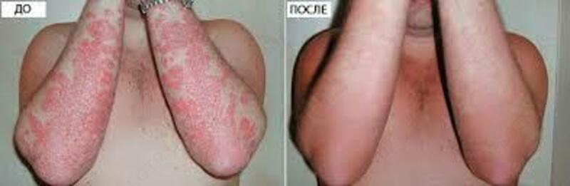 Крем "Король кожи"