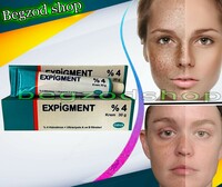 Shifoshop.Uz - Крем отбеливающий Expigment