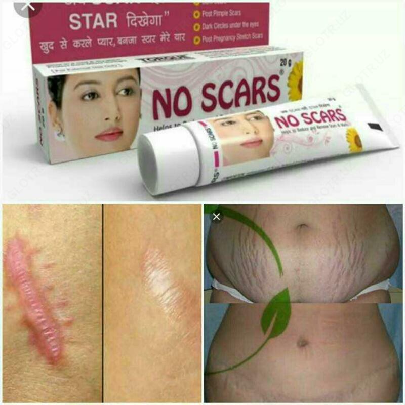 100 000 сум Крем от шрамов No scars