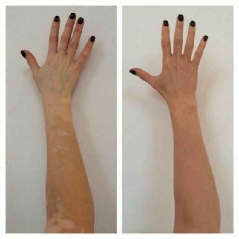 Viticolor Viticolor jeli Chakana savdo