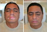 Viticolor Viticolor jeli Shifoshop.Uz