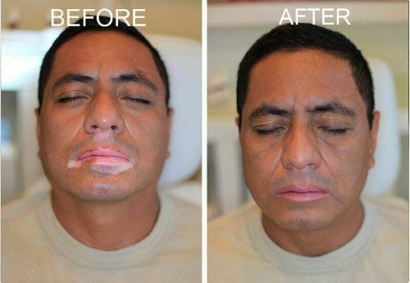 Viticolor Viticolor jeli Shifoshop.Uz