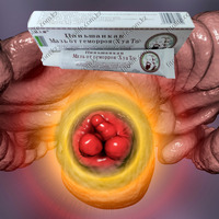 Мазь от геморроя "Пиньшанкан" - 110 000 сум