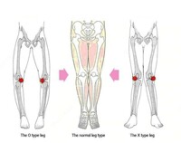 Корректор для кривых ног Jorzilano Только в розницу