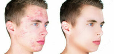 Teri muammolari uchun Safi siropi 100 ml Chakana savdo