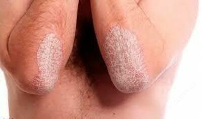 Сафи (safi)сироп от проблемной кожи