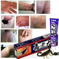 Противогрибковая мазь c ядом скорпиона Shifoshop.Uz