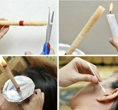 Fito shamlar (quloq shamlari) Shifoshop.Uz