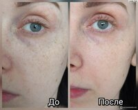 Shifoshop.Uz - Отбеливающий крем Аchroactive max