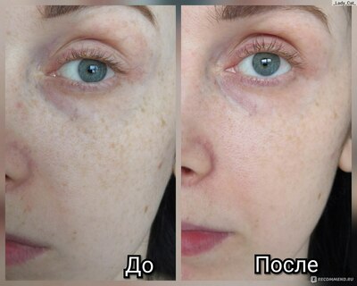 Отбеливающий крем Аchroactive max