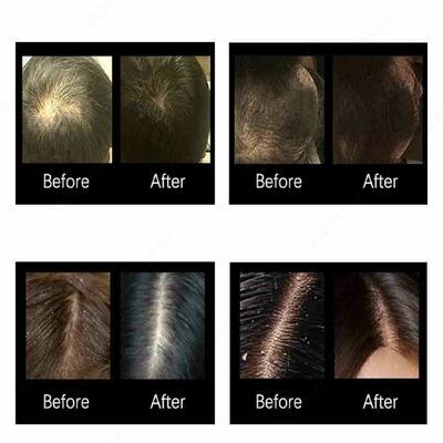 Mo''jizaviy soch yog'i Chakana savdo