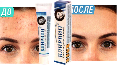 Клирвин (против пятен прыщей и шрамов на коже)