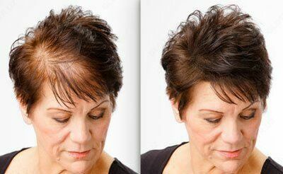 Загуститель волос Toppik большой 27.5 гр Только в розницу