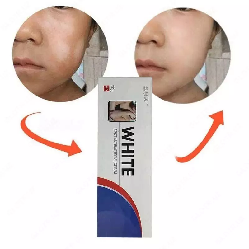 Антибактериальная мазь против витилиго Shifoshop.Uz