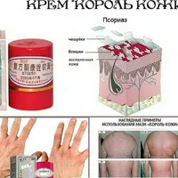 65 000 сум Тайская мазь Король кожи от псориаза