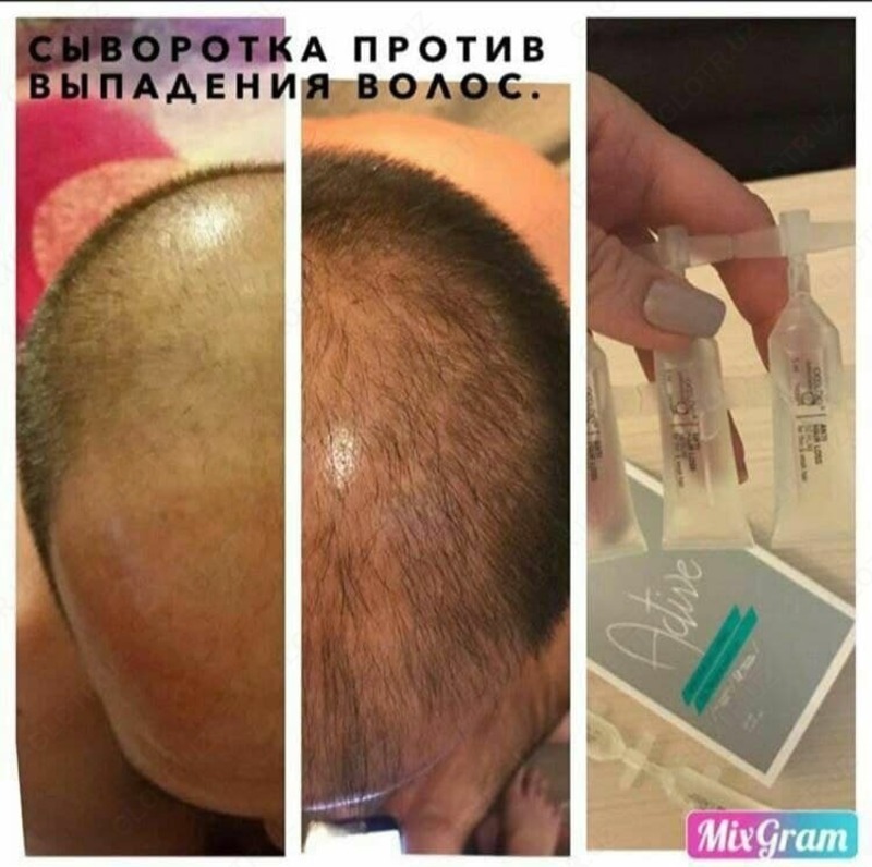 Сыворотка против выпадения волос Active - 355 000 сум