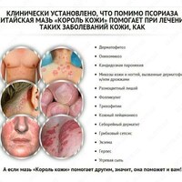 dermatit va boshqa teri kasalliklarga qarshi krem. "Король кожа"