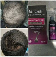 Preparat Minoxidil 10% (Minoxidil 10%) 60 ml.