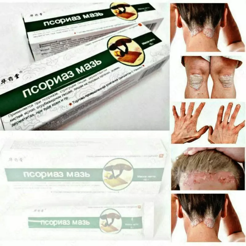 Китайская мазь от псориаза ЛИНЧЖИ  15 г (псориаз мазь)