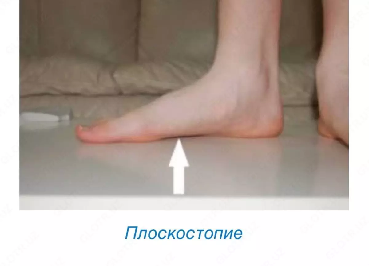 2022-02-21-01-42-02-899086-511e9cffd2ccfcfd5aa42c914f207849.webp?_=ozbol