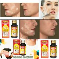  бакучи хвост - 