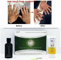 Vitiligo vositasi - 175 000 so'm