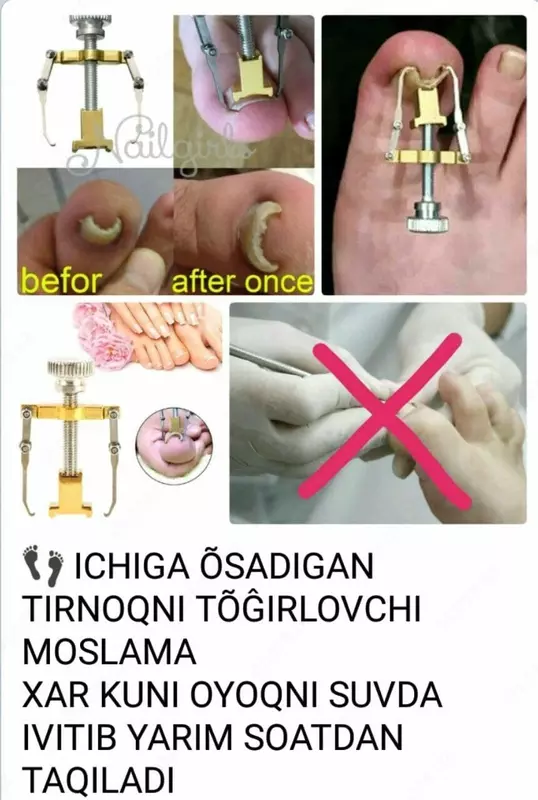 Ingichka Tirnoqlarni to'g'rilash uchun tuzatuvchi Chakana savdo