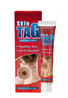 ﻿Набор для удаления папиллом Micro Skin Tag Remover Kit