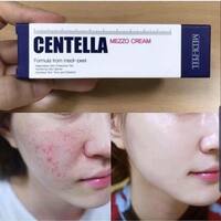Успокаивающий крем Medi-Peel Centella Mezzo Cream