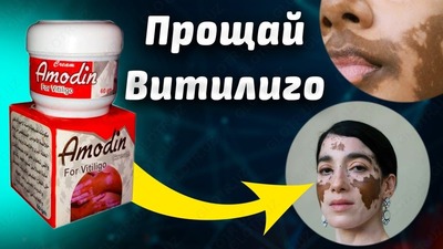 Harrazdan vitiligoni davolash uchun amodinli krem