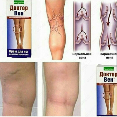 Крем для ног Доктор вен