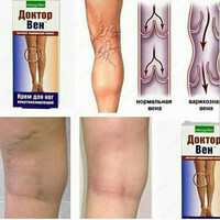 100 000 so'm Vena doktori uchun oyoq kremi