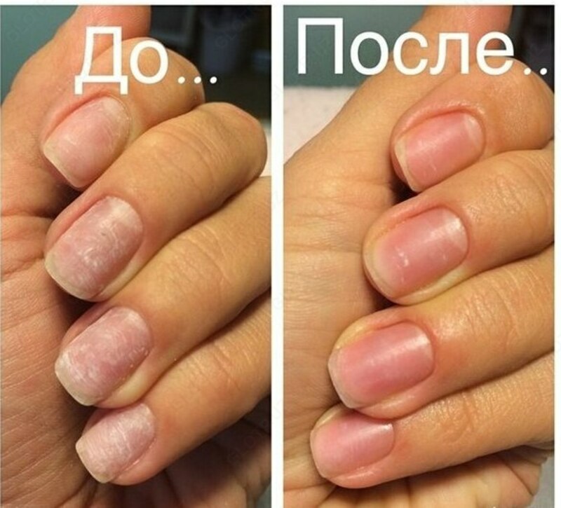 250 таблеток