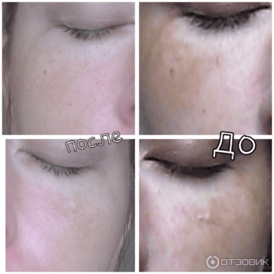 Oqartiruvchi krem ​​ACHROACTIVE MAX