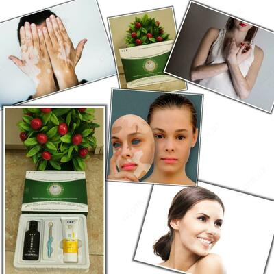 Комплекс специальных восстанавливающих средств для витилиго