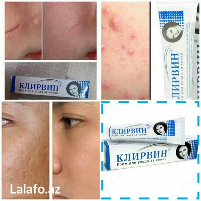 Клирвин (против пятен прыщей и шрамов на коже)