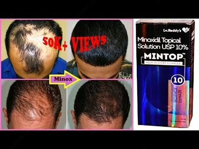 Mintop 10 - лосьон для волос на основе миноксидила