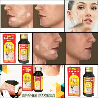 Масло Бакучи таил