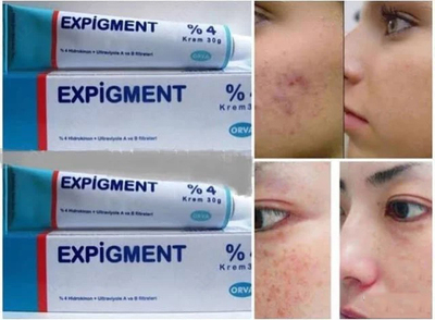 Крем отбеливающий Expigment