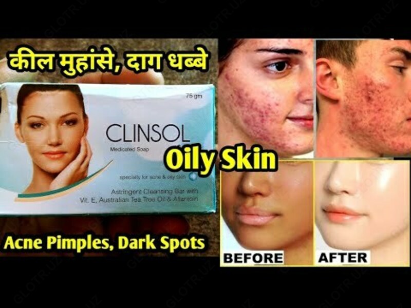 Slinzol gel yuz kremi
