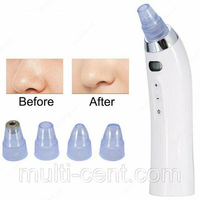 Вакуумный очиститель пор лица Derma Suction