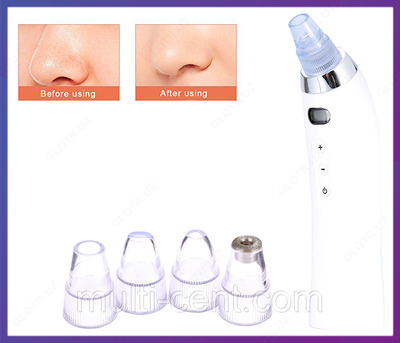 Вакуумный очиститель пор лица Derma Suction