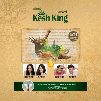 Kesh King Ayurveda soch yog'i 100ml