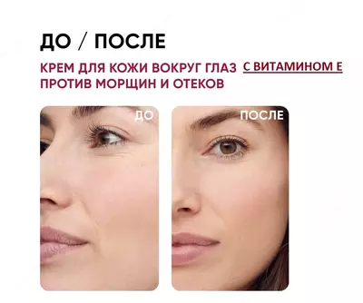 Qarishga qarshi ko'z kremi E VITAMINI