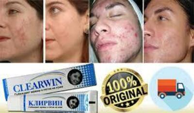 Крем Клирвин от шрамов - 76 000 сум / шт.