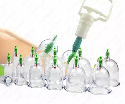 Набор массажных вакуумных банок для Хиджамы (24 шт)