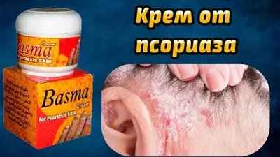 Крем "Basma" от псориаза (60 мл) - 160 000 сум / упаковка