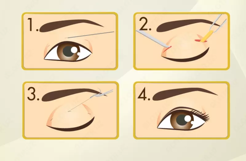 Сангапури (пластика азиатских век)