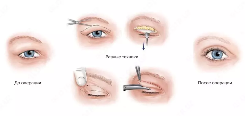 Сангапури (пластика азиатских век)